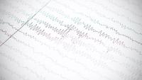 eeg scan/brainwaves